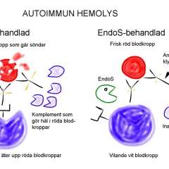 Illustration visar hur antikroppar förstör röda blodkroppar vid autoimmun hemolys. Jämför obehandlad och EndoS-behandlad process.
