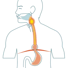 Illustration av matsmältningssystemet med fokus på halsen och magsäcken. Kan visa tolvfingertarmen inflammation symtom.