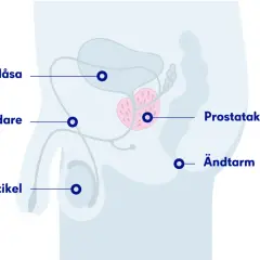 Illustration av manliga reproduktionsorganen med prostatan i fokus. PSA-prov ålder kan vara relevant för att följa prostatan.