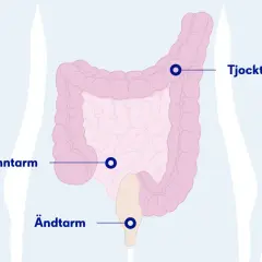 Illustration av tunntarm, tjocktarm och ändtarm. Kan indikera var ont i nedre delen av magen kan sitta.
