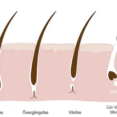 Illustration av hårsäckens cykel: aktiv tillväxt, övergångsfas, vilofas och ny tillväxt. Kan relateras till håravfall vid klimakteriet.
