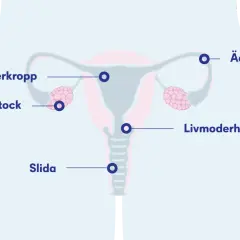 Illustration av kvinnans reproduktionsorgan med livmoder, äggstockar, äggledare och slida. En cysta kan uppstå i livmodern eller äggstocken.