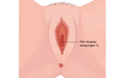 Illustration av en vulva med texten "Här stoppas tampongen in". Kan relateras till torra slemhinnor klimakteriet.