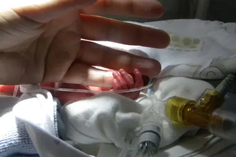 En vuxen hand vilar över en nyfödd bebis hand. Bebisens lilla hand ser ut att ha ett prematurt utseende, omgiven av medicinsk utrustning.