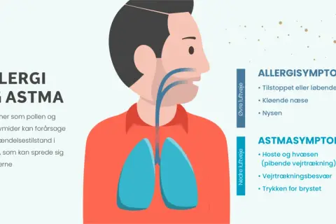 Illustration av en person med lungor och luftvägar. Allergener som pollen kan orsaka symtom.