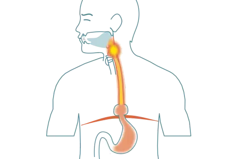 Illustration av matsmältningssystemet med fokus på halsen och magsäcken. Kan visa tolvfingertarmen inflammation symtom.