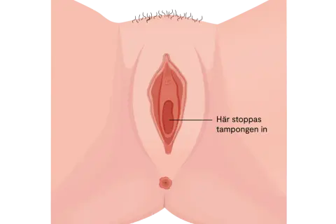 Illustration av en vulva med texten "Här stoppas tampongen in". Kan relateras till torra slemhinnor klimakteriet.