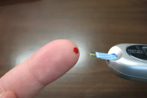 Blodsdroppe på fingret redo för mätning av blodsocker fastande med glukosmätare.