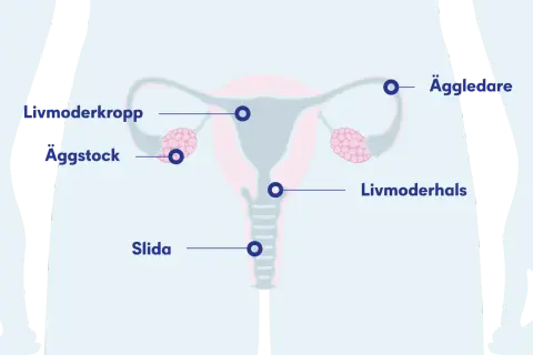Illustration av kvinnans reproduktionsorgan med livmoder, äggstockar, äggledare och slida. En cysta kan uppstå i livmodern eller äggstocken.