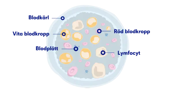 Illustration av blodkroppar, blodplättar och lymfocyter. Låga nivåer av röda blodkroppar kan vara ett av anemi symtom.