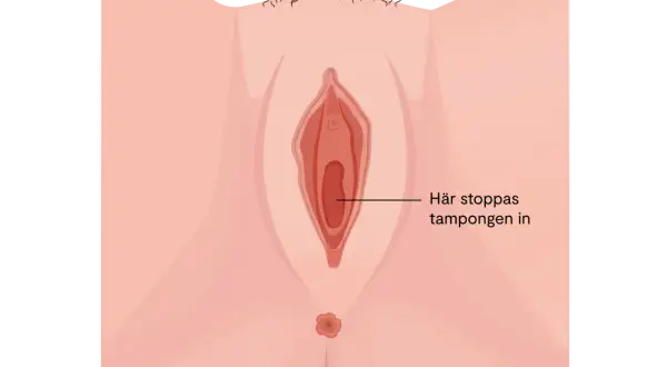 Illustration av en vulva med texten "Här stoppas tampongen in". Kan relateras till torra slemhinnor klimakteriet.