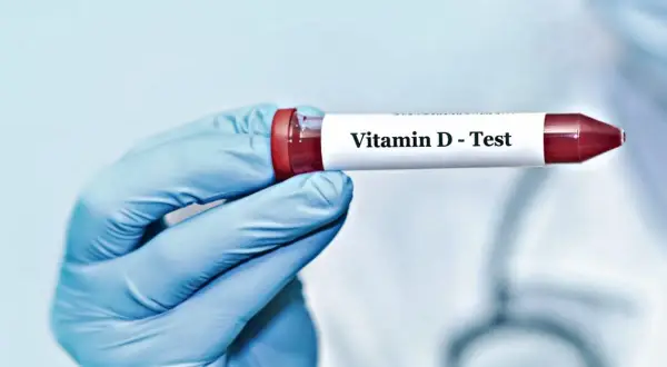 Blå handskbeklädd hand håller provrör märkt "Vitamin D - Test". Kan hjälpa till att identifiera d-vitamin brist symtom.