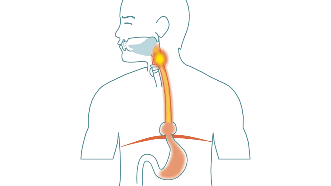 Illustration av matsmältningssystemet med fokus på halsen och magsäcken. Kan visa tolvfingertarmen inflammation symtom.