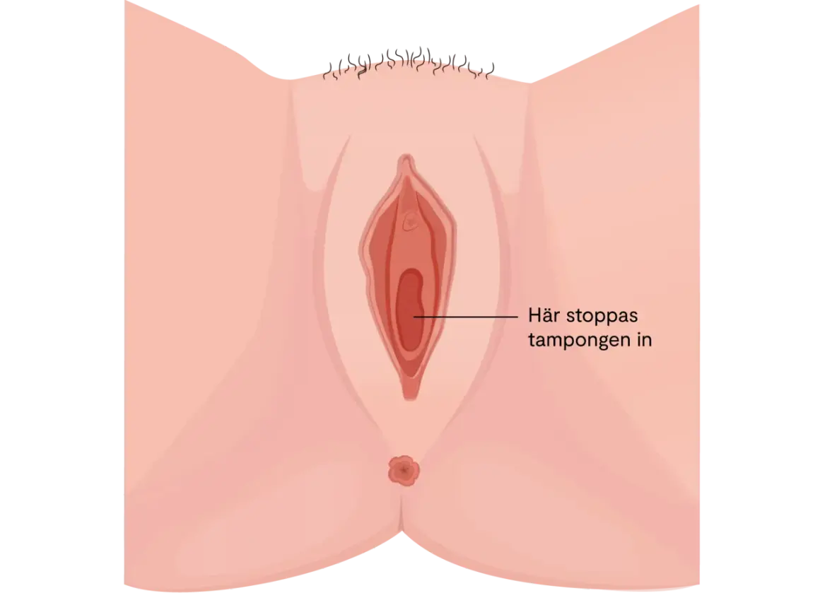 Illustration av en vulva med texten "Här stoppas tampongen in". Kan relateras till torra slemhinnor klimakteriet.