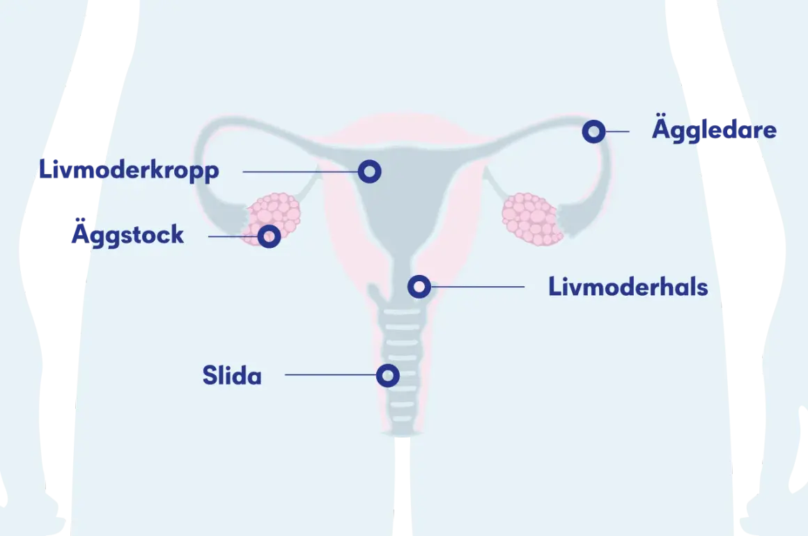 Illustration av kvinnans reproduktionsorgan med livmoder, äggstockar, äggledare och slida. En cysta kan uppstå i livmodern eller äggstocken.