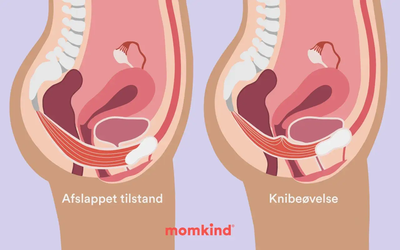 Illustration visar bäckenbotten i avslappnat och kontraherat läge. Kan hjälpa vid ont i underlivet gravid.