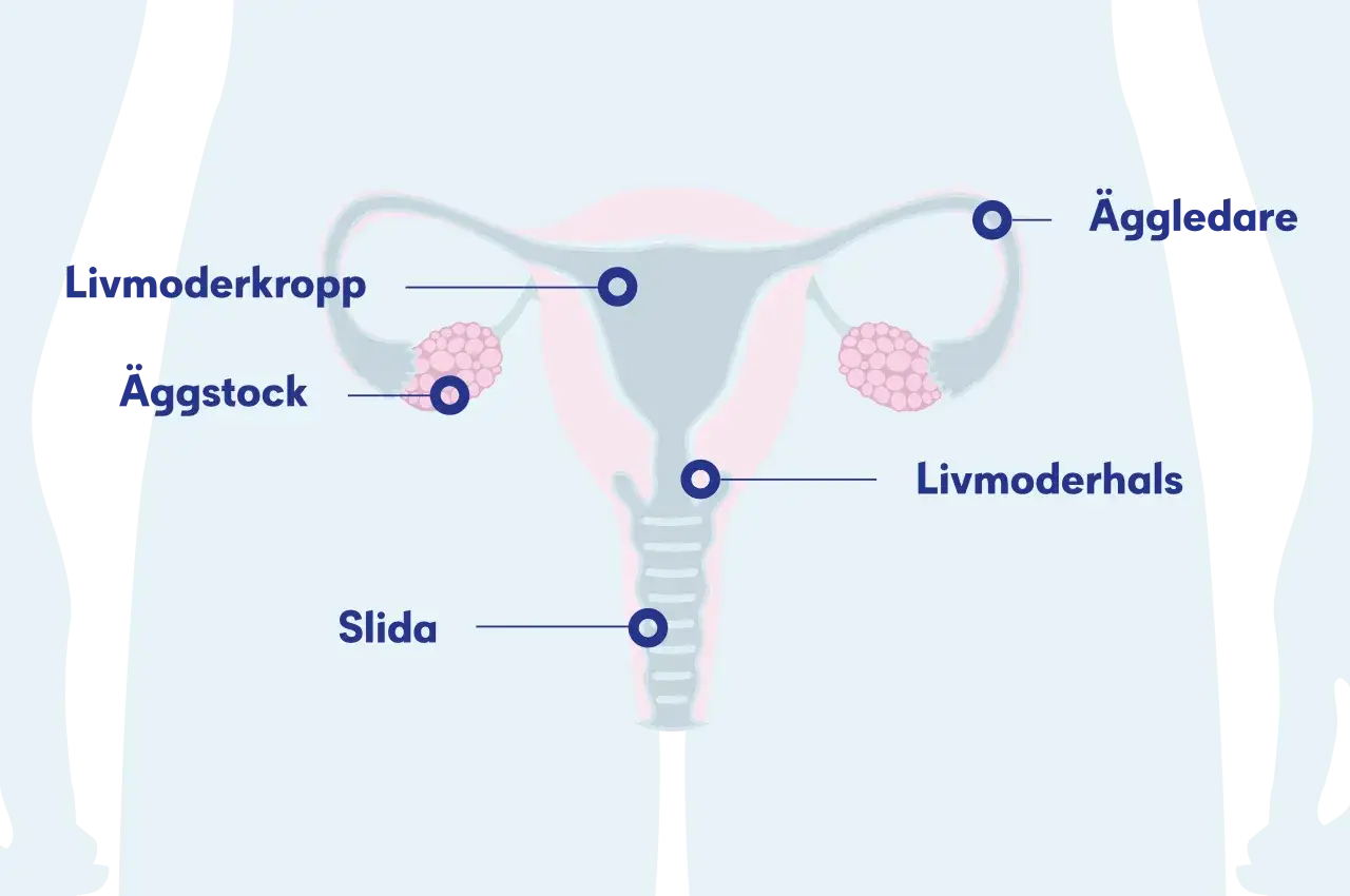 Illustration av kvinnans reproduktionsorgan med livmoder, äggstockar, äggledare och slida. En cysta kan uppstå i livmodern eller äggstocken.
