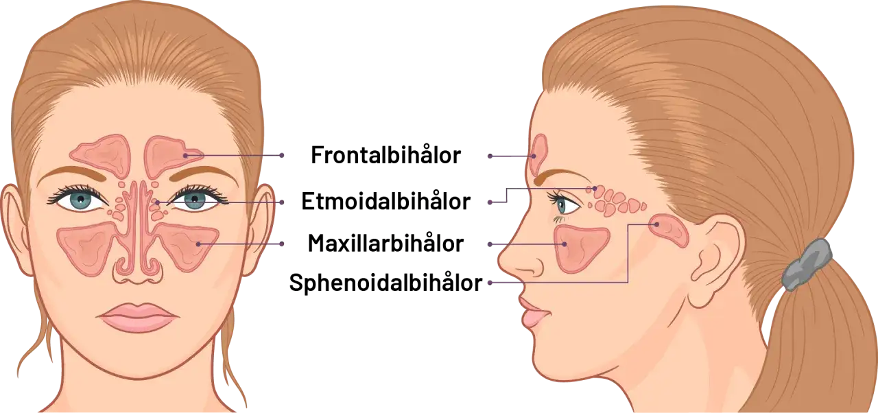 Illustration av bihålorna i ansiktet, som visar var bihåleinflammation symtom kan uppstå.