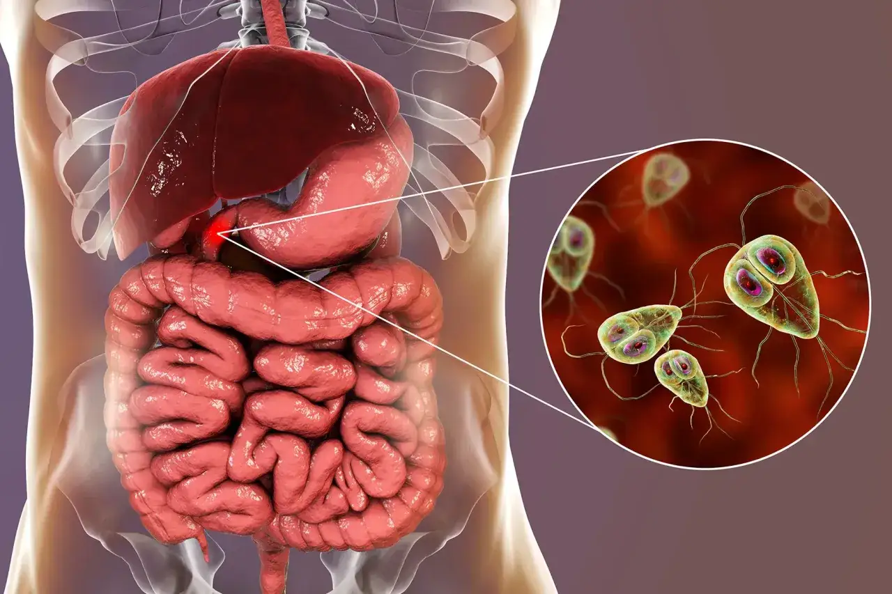 Illustration av Giardia-parasiter som orsakar tolvfingertarmen inflammation symtom.