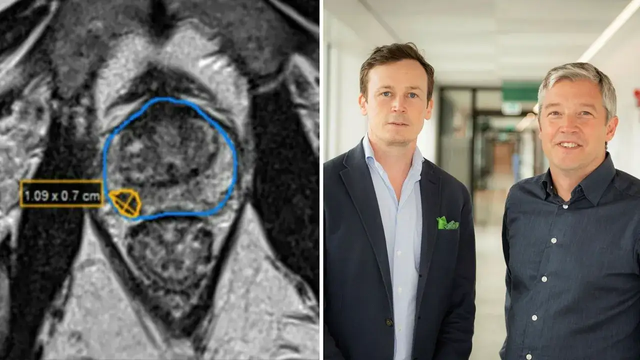 MR-bild av prostata med mått, bredvid två män. Viktigt för psa-prov ålder.