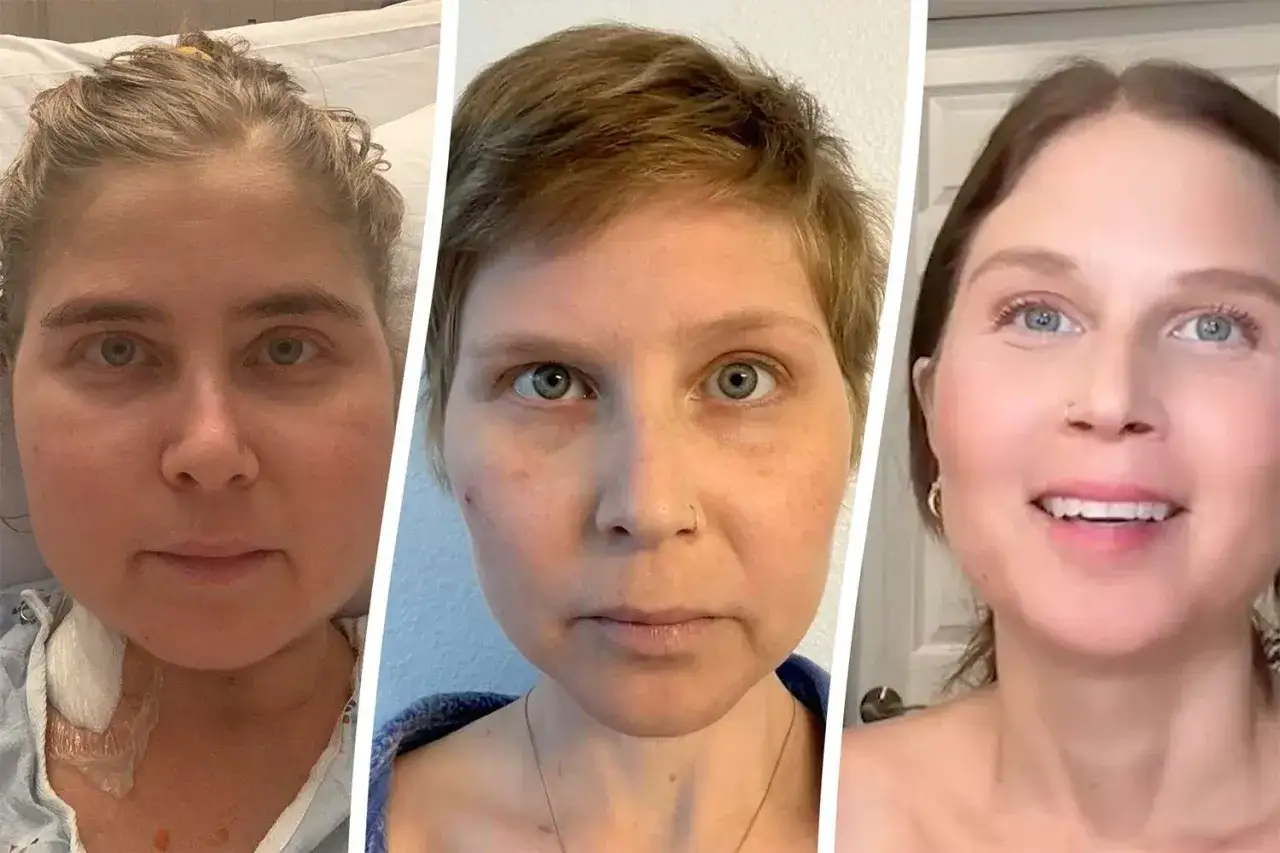 Triptyk visar en kvinnas ansikte i tre stadier, med synliga förändringar som kan kopplas till binjurarna symptom ansiktet.