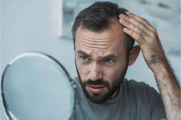 Man med skägg och bekymrat uttryck undersöker sitt tunnare hår i spegeln, möjligtvis relaterat till hypotyreos håravfall.