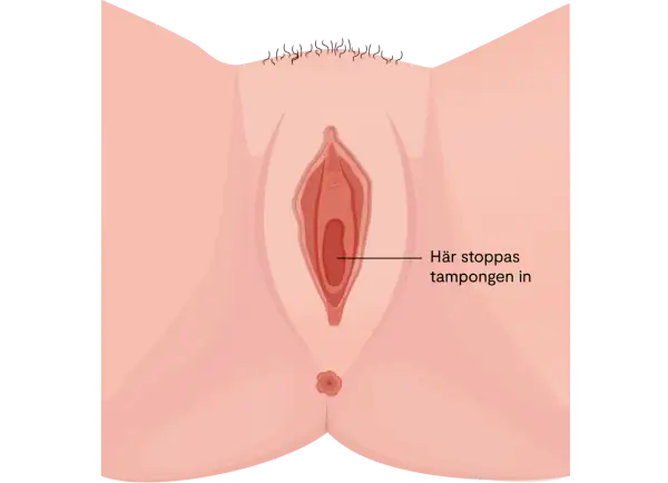 Illustration av en vulva med texten "Här stoppas tampongen in". Kan relateras till torra slemhinnor klimakteriet.